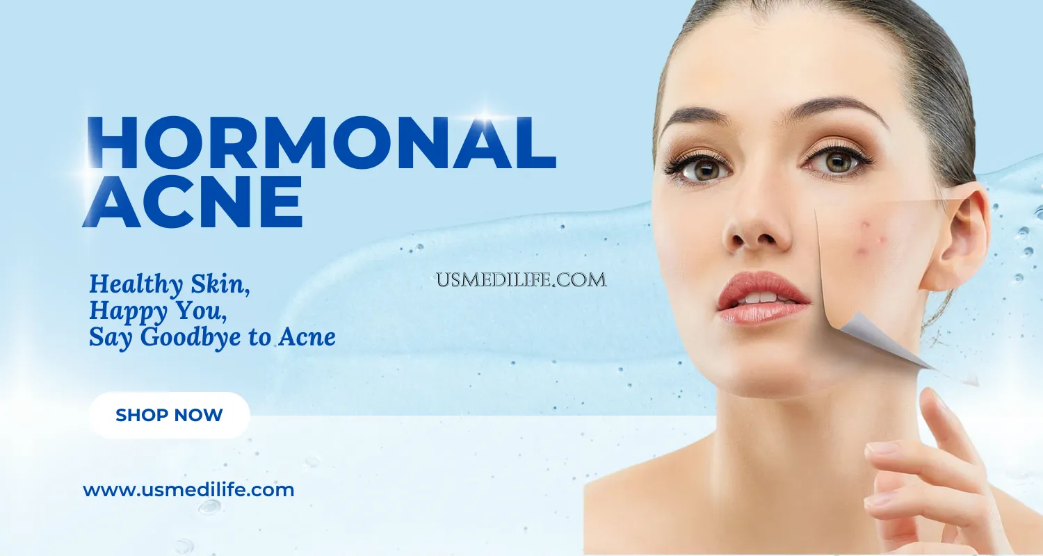 Hormonal Acne Explained: Causes, Symptoms, and Treatment Options                    